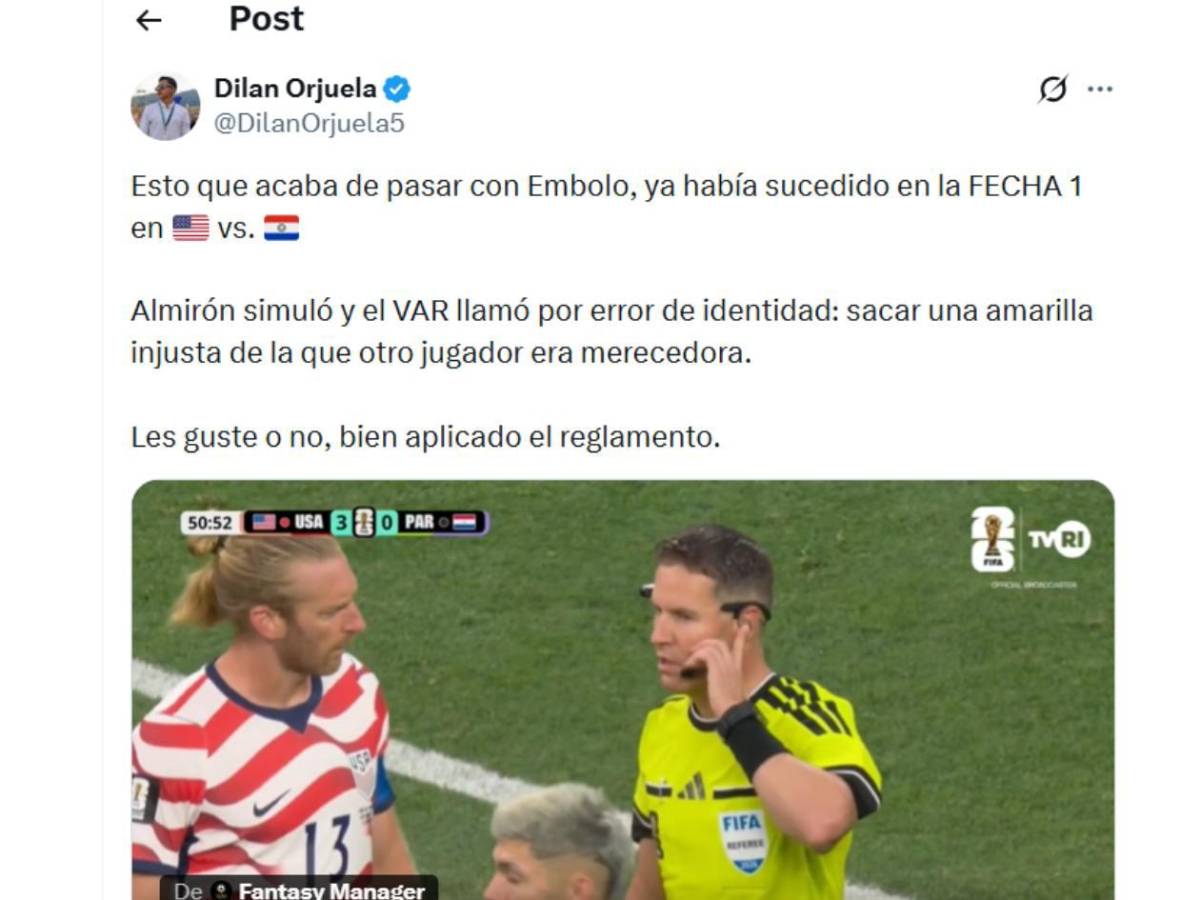 Destapan la verdad de la roja a Embolo y la otra polémica a Argentina que nadie vio