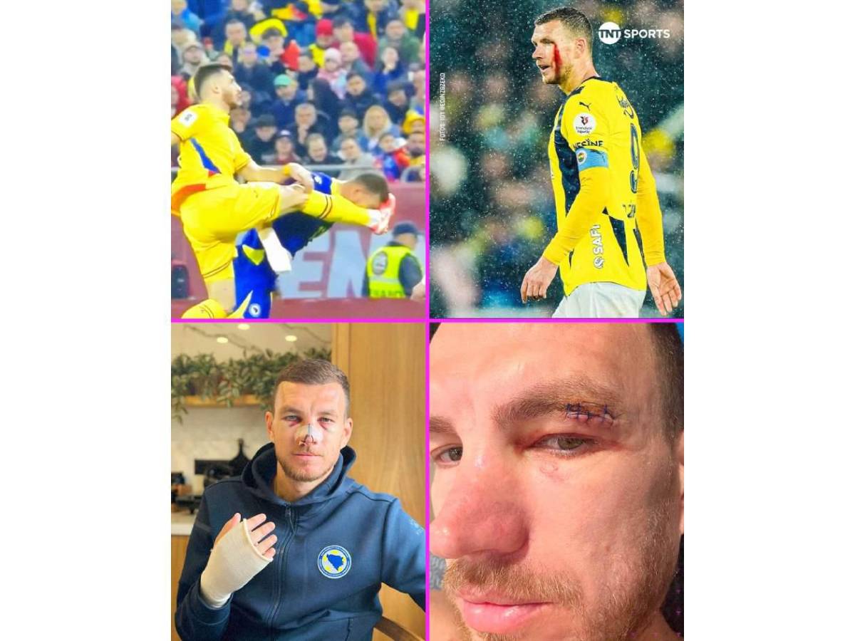 ¡Terrible! Sufrió brutal patada en partido y revela cómo le quedó el rostro