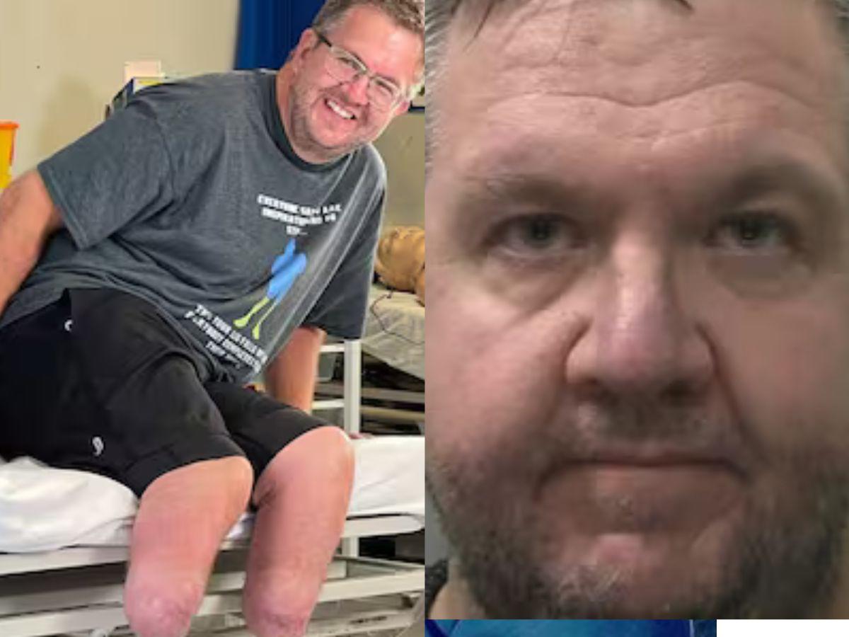 Cirujano se corta las piernas para cobrar millonario seguro