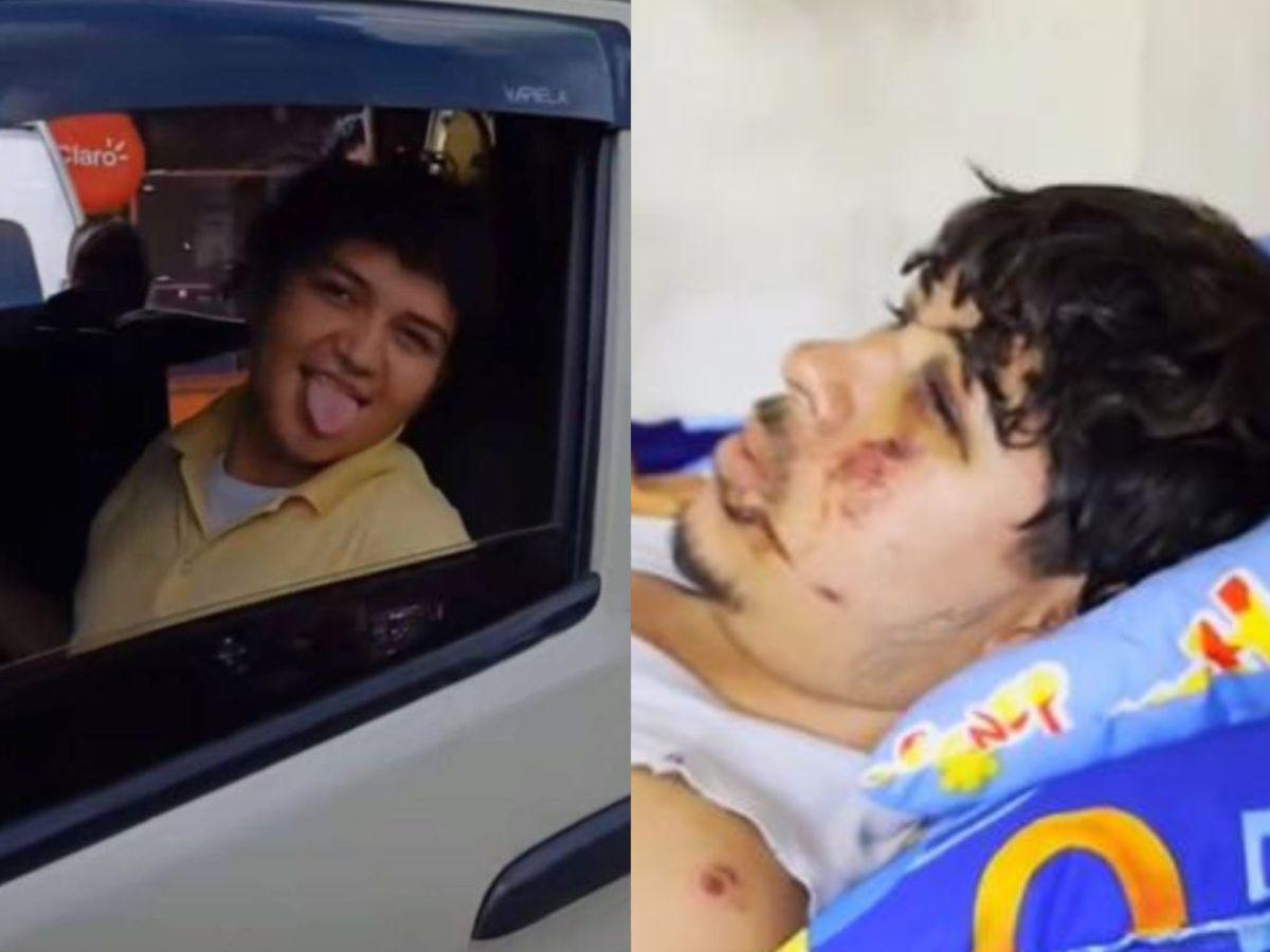 Ayudante descarta fallas en el rapidito accidentado en la colonia Lempira: El bus iba bien