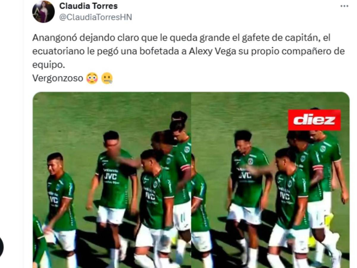 Alexy Vega reacciona: Exigen castigo a Anangonó y su cachetada le da la vuelta al mundo