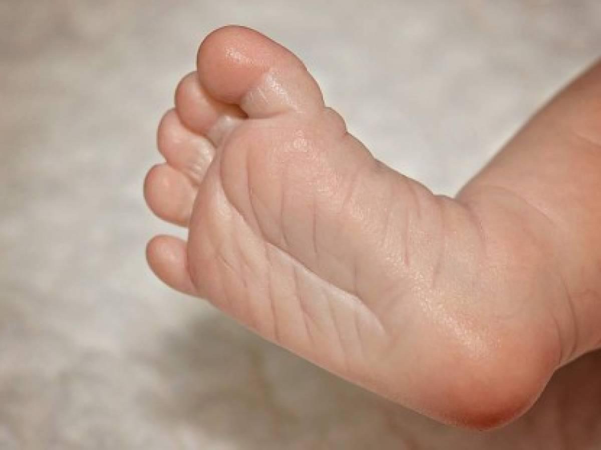 En estado de putrefacción encuentran cadáver de recién nacida