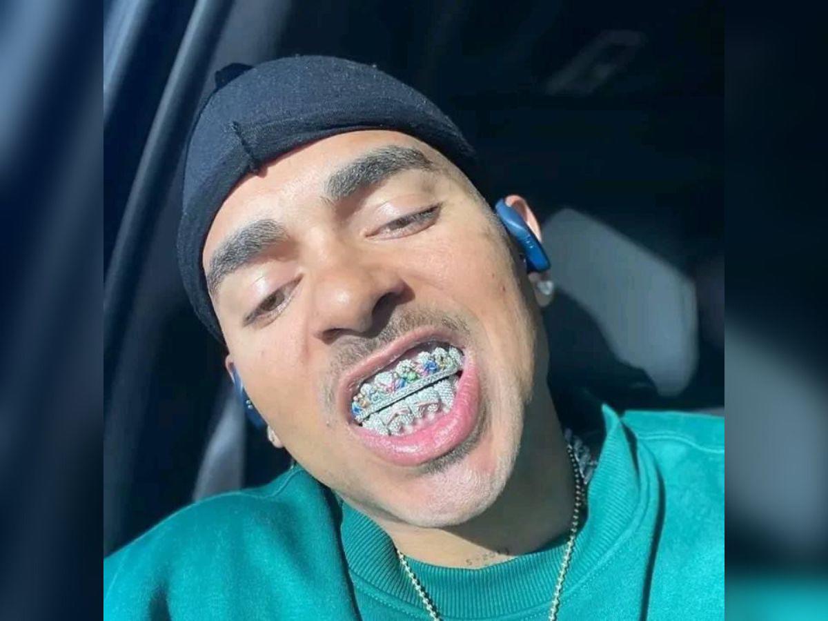 Ozuna presume su nueva dentadura de diamantes