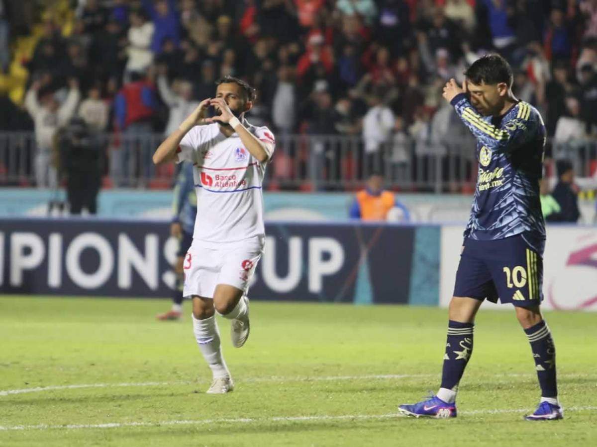 Olimpia se derrumba ante América, dedicatoria de Jorge Álvarez y novia de futbolista