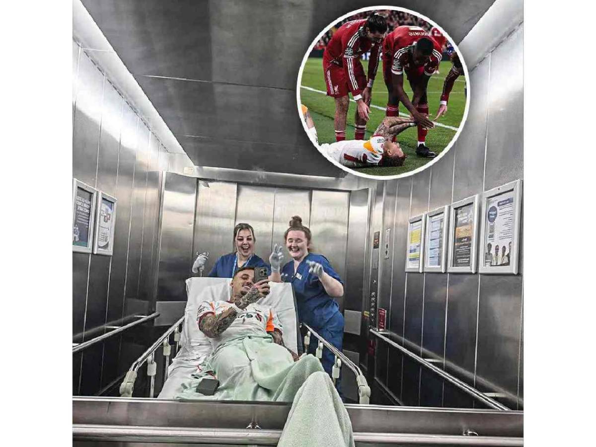 Impactante relato tras insólita lesión en Champions: “Mi pulgar quedó colgando”