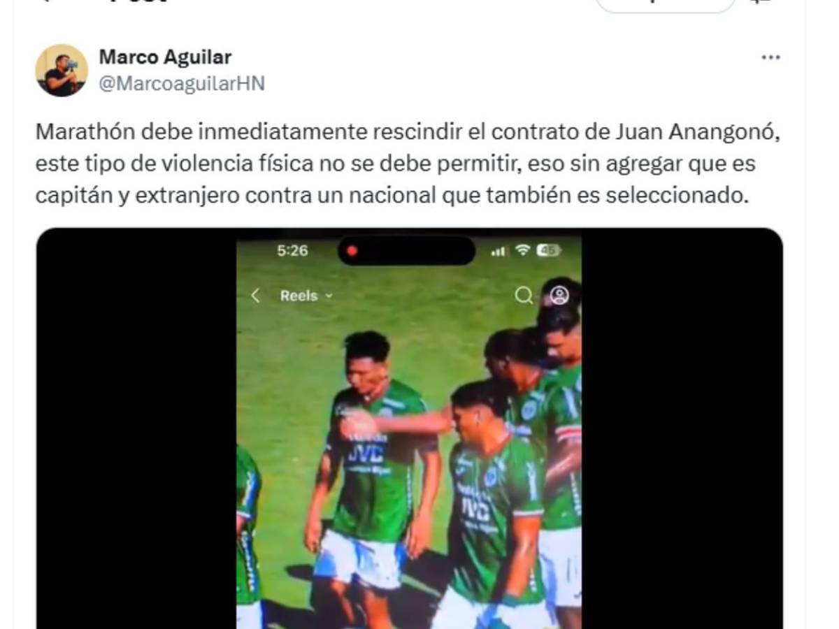 Alexy Vega reacciona: Exigen castigo a Anangonó y su cachetada le da la vuelta al mundo