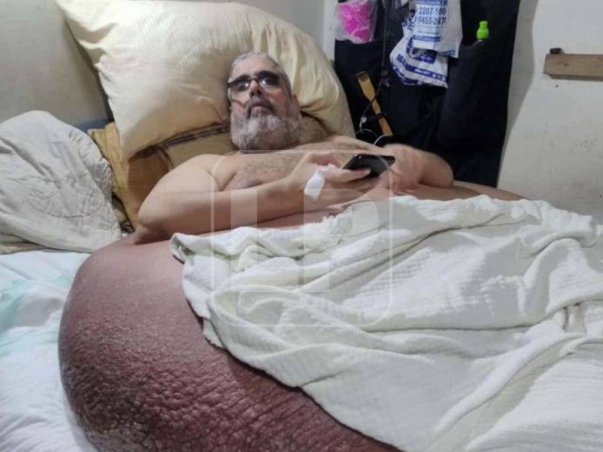 ¿Qué fue de Basima y Nasser Hilsaca, los hermanos más obesos de Honduras?