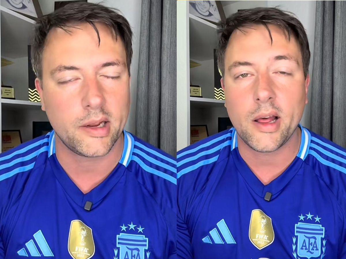 Gustavo Leone sufre parálisis facial después de comprometerse con Karlen Pérez