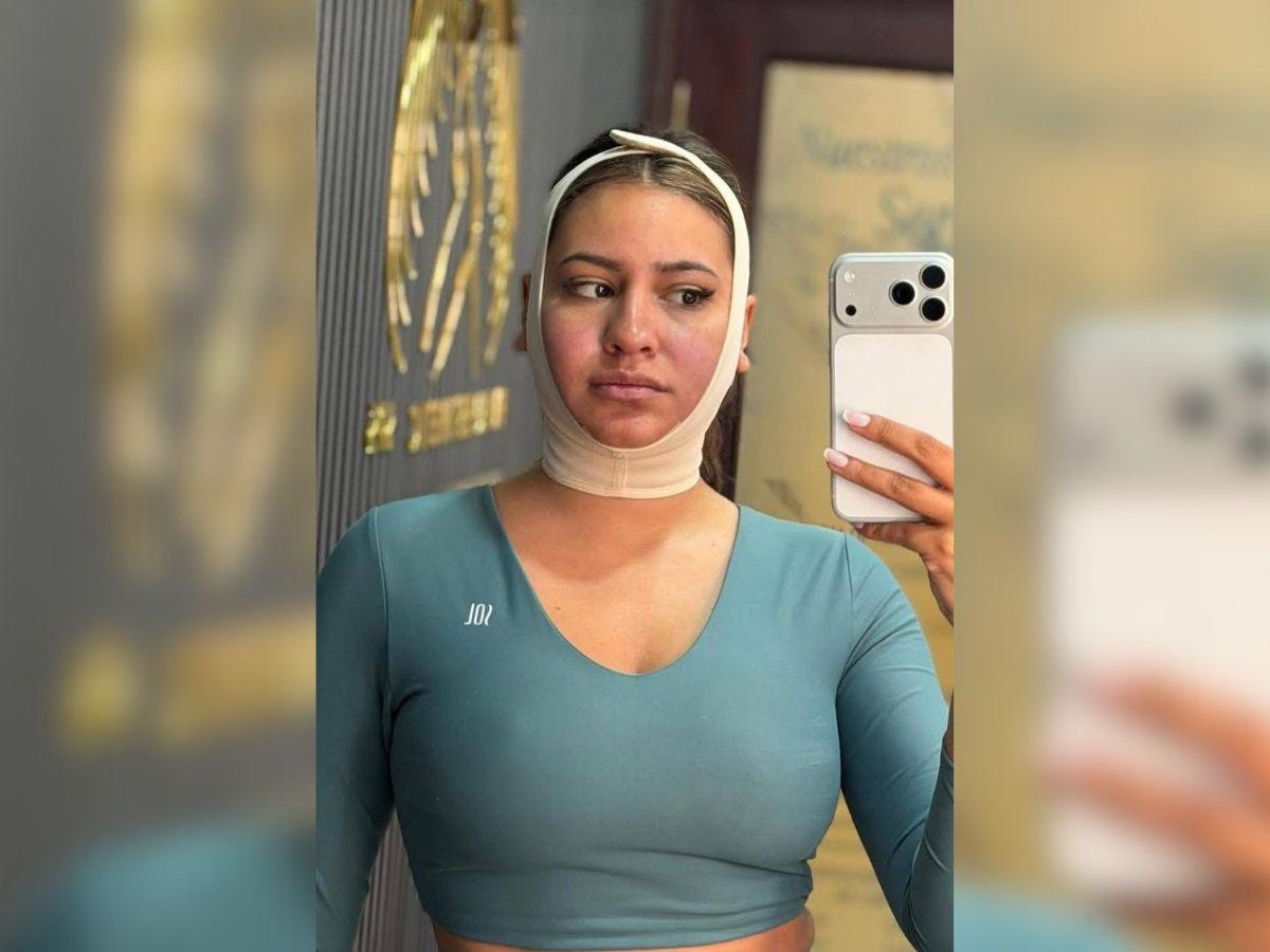 Alejandra Rubio revela el precio de su costosa cirugía