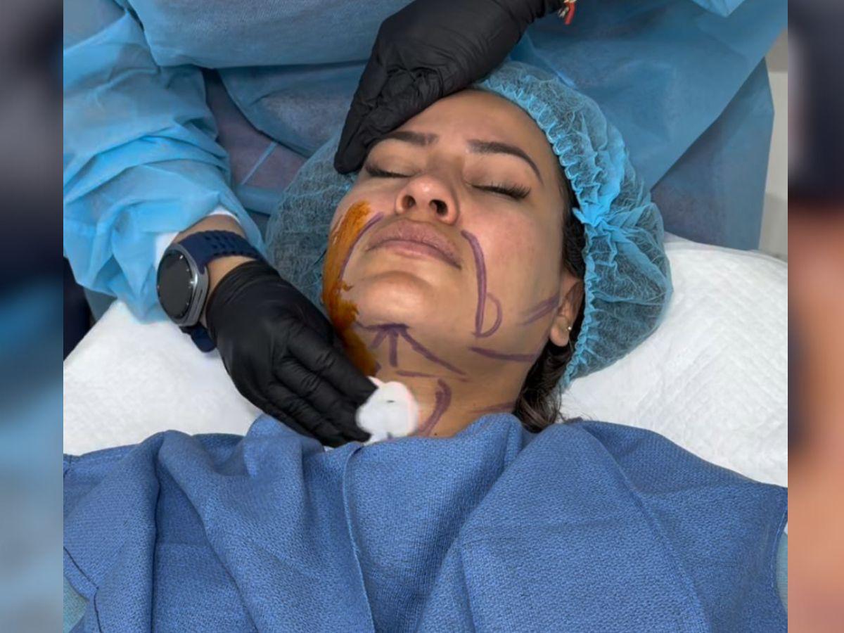 Alejandra Rubio se somete a nuevo procedimiento estético