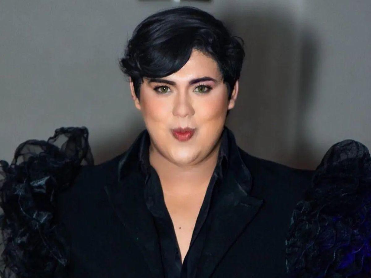 Antonio Sandrez presume sus nuevos labios: “Atáquense y admiren