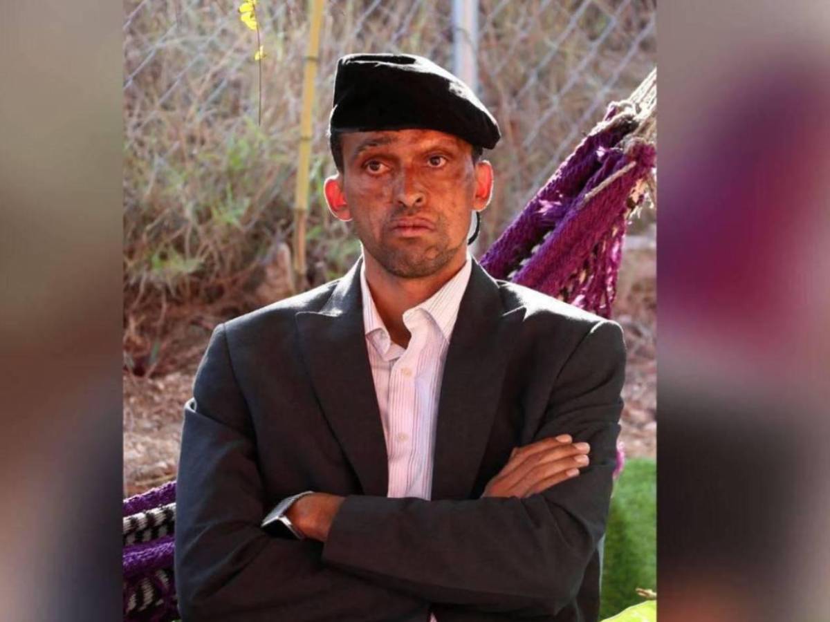 Tiktokers de Honduras vs El Salvador: Funcionario pide jugar la revancha