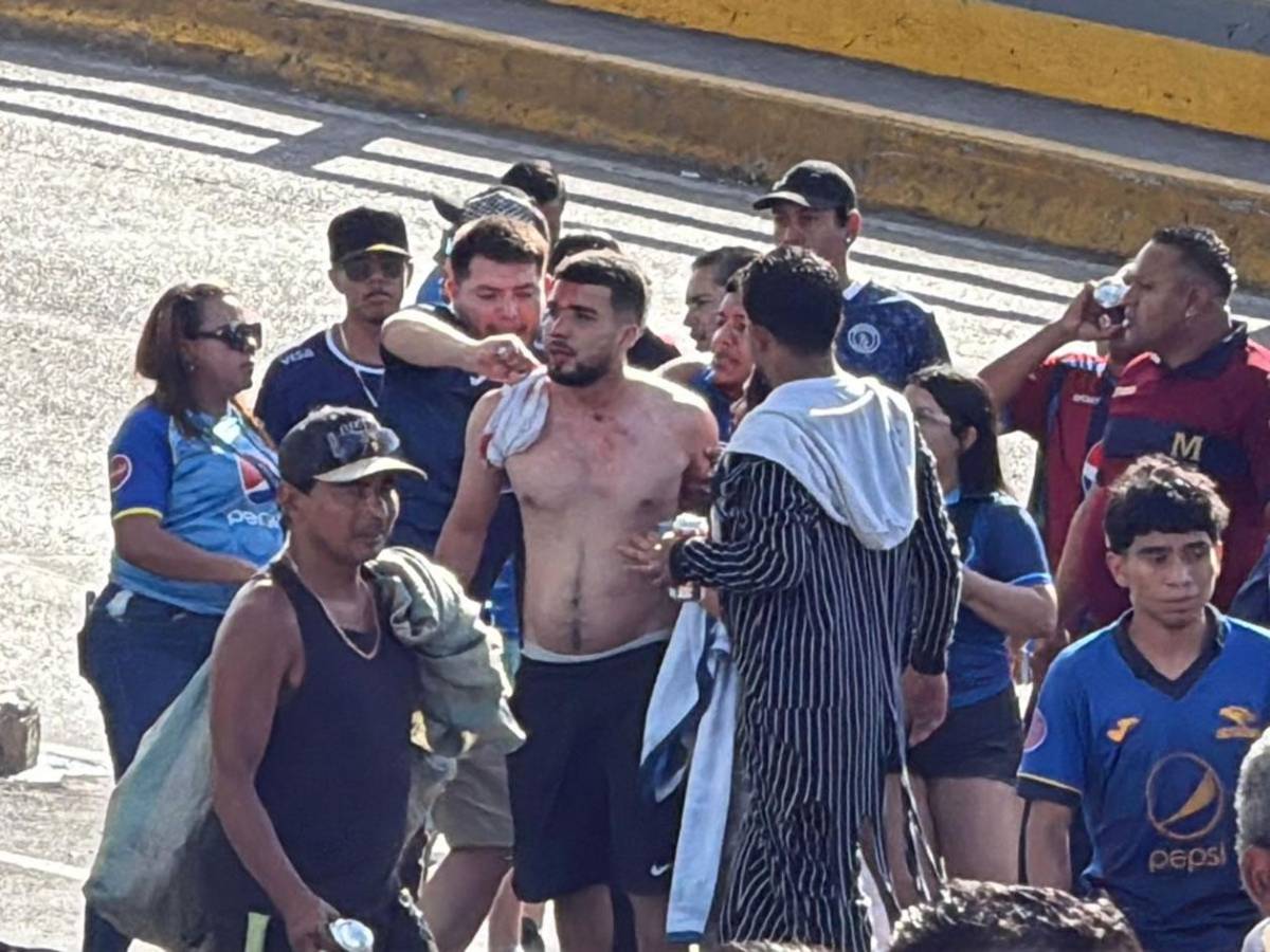 Héroe de Olimpia, llanto del villano de Motagua, disturbios, heridos y bellezas