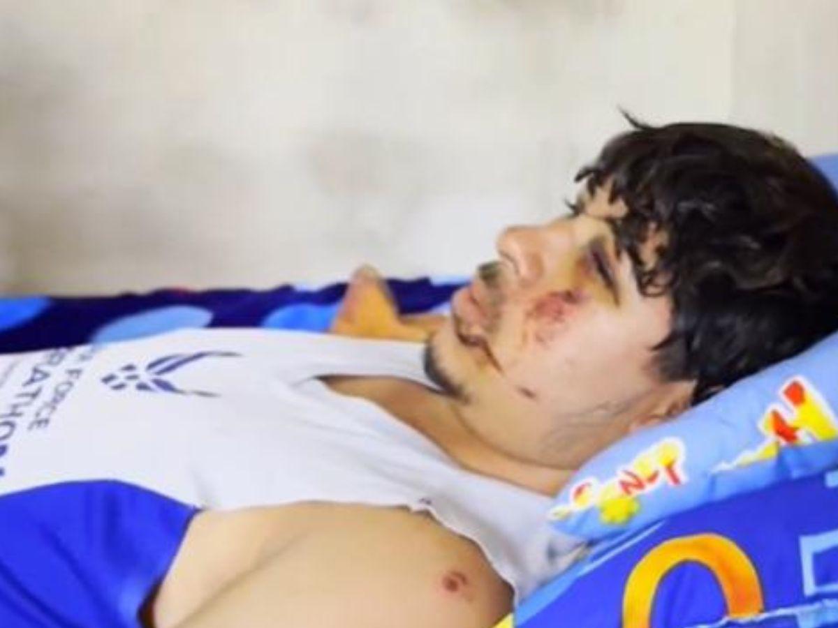 Ayudante descarta fallas en el rapidito accidentado en la colonia Lempira: El bus iba bien