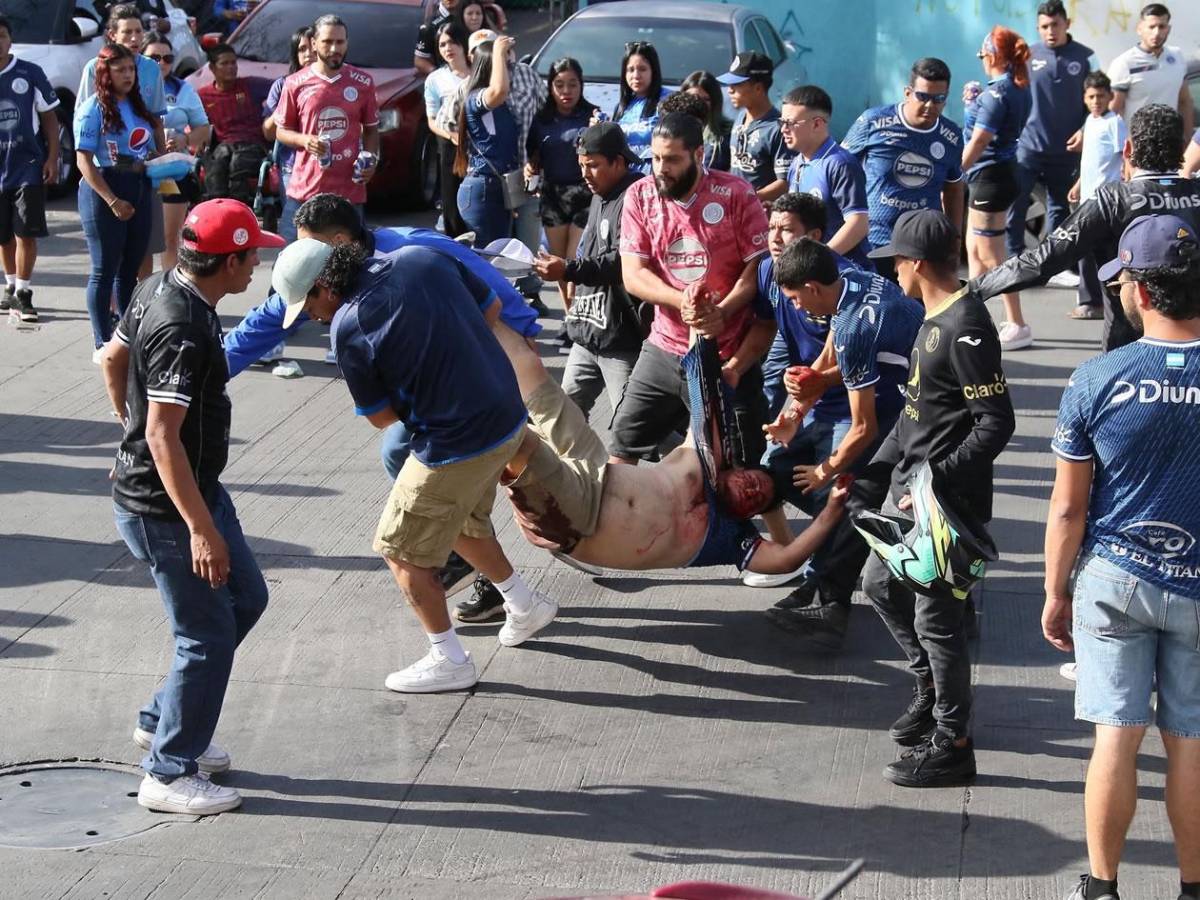 Héroe de Olimpia, llanto del villano de Motagua, disturbios, heridos y bellezas