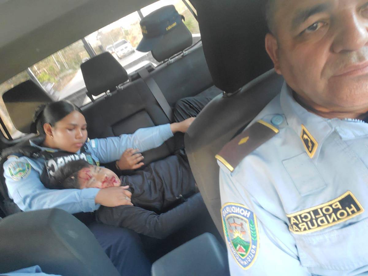 Lista de los heridos en brutal accidente entre bus y rastra en Quimistán