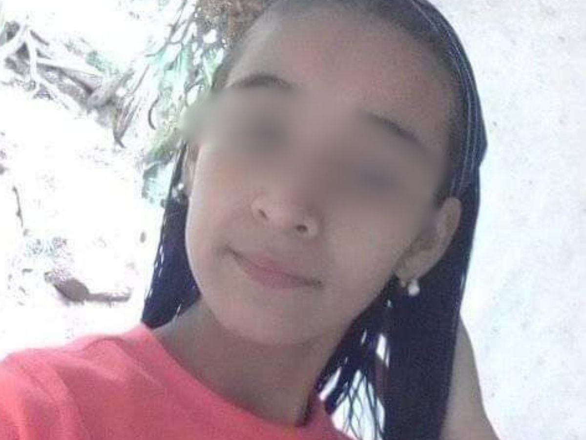 Madre e hija resultan quemadas con pólvora en Copán