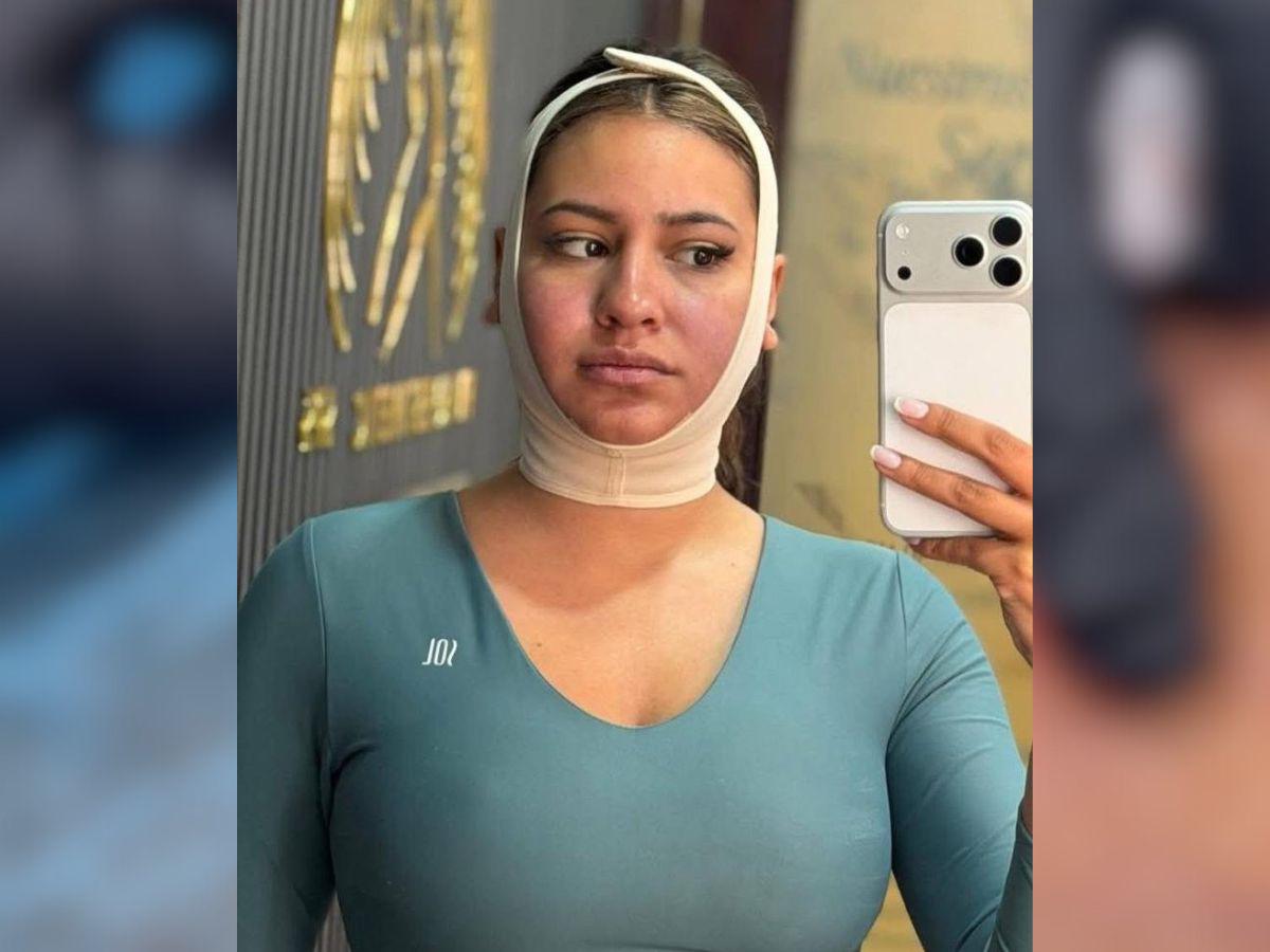 Alejandra Rubio se somete a nuevo procedimiento estético