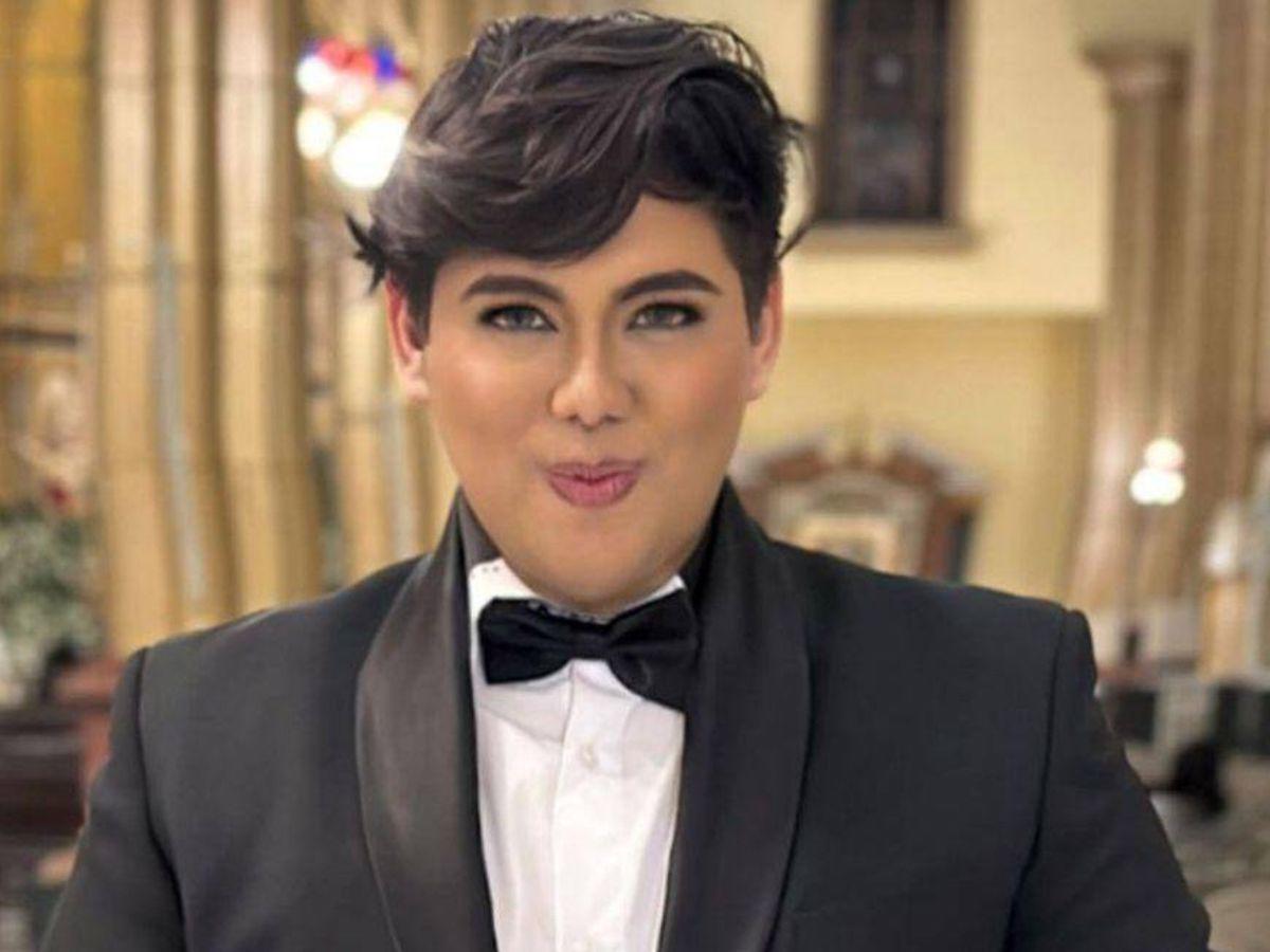 Antonio Sandrez presume sus nuevos labios: “Atáquense y admiren