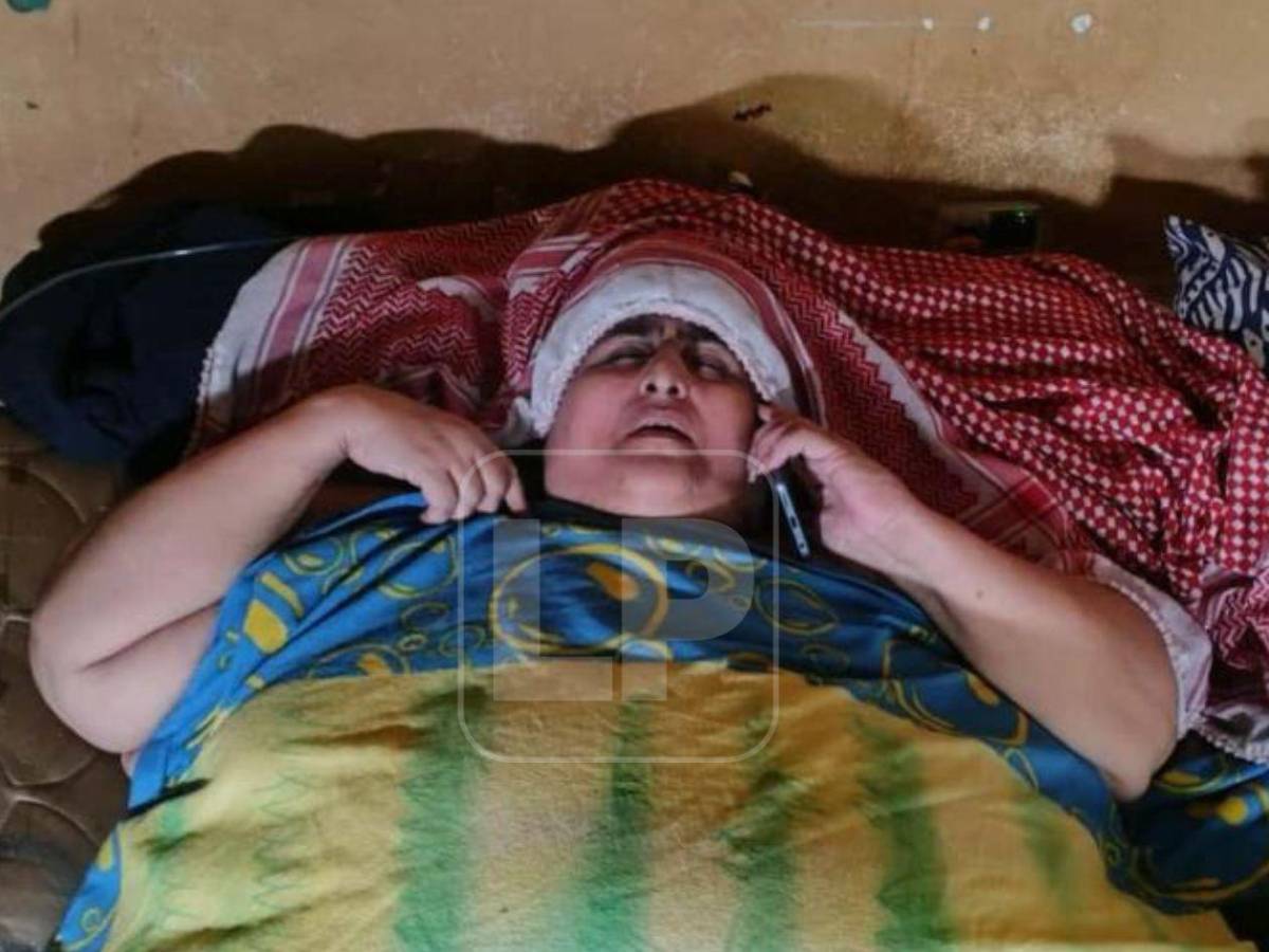 ¿Qué fue de Basima y Nasser Hilsaca, los hermanos más obesos de Honduras?