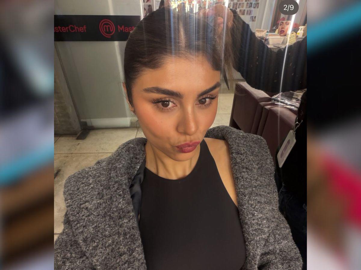 Querida participante de ‘MasterChef Celebrity′ sufre accidente con aceite caliente en su rostro