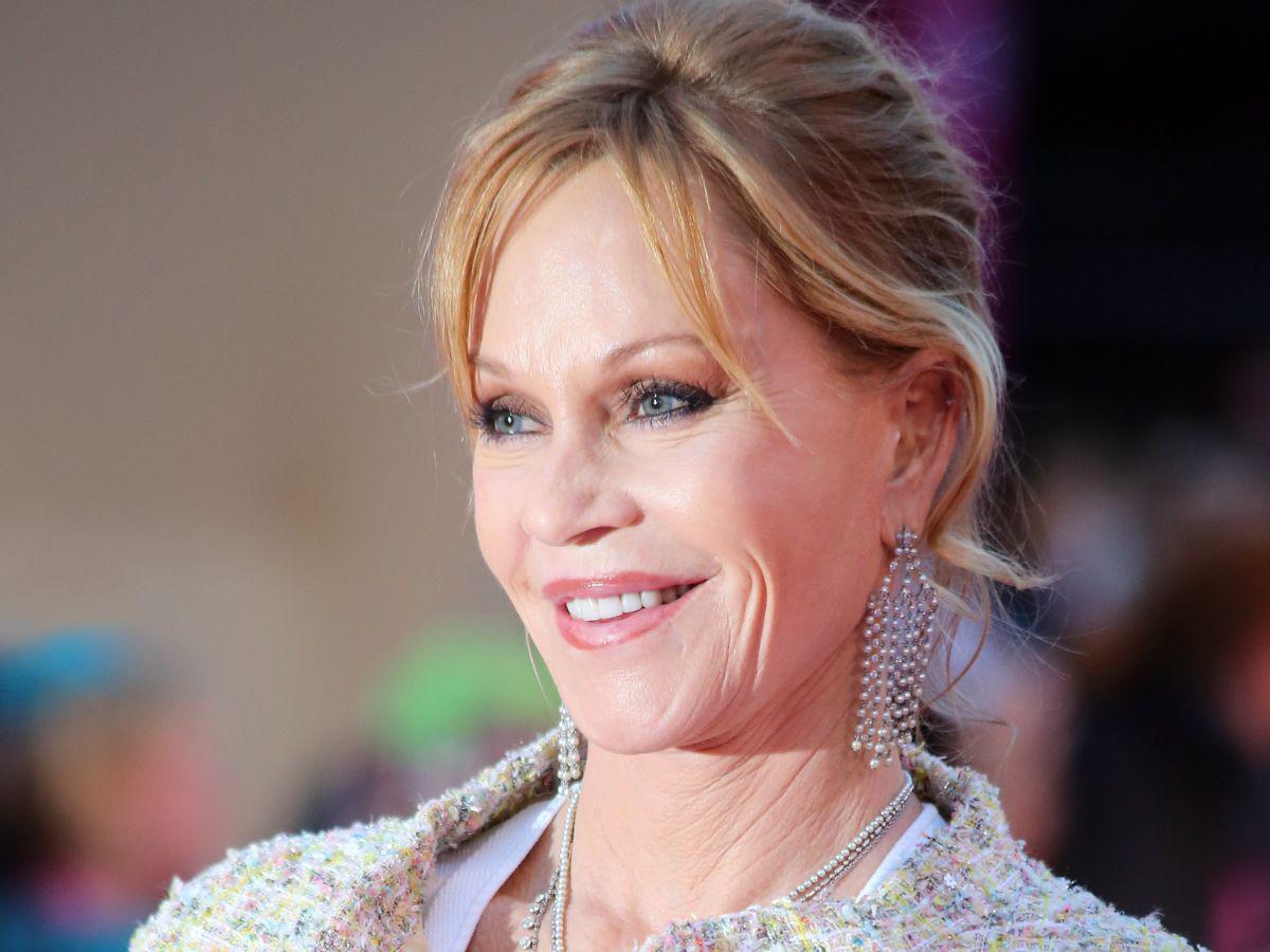 Captan a Melanie Griffith con extraños moretones en su cara y manos