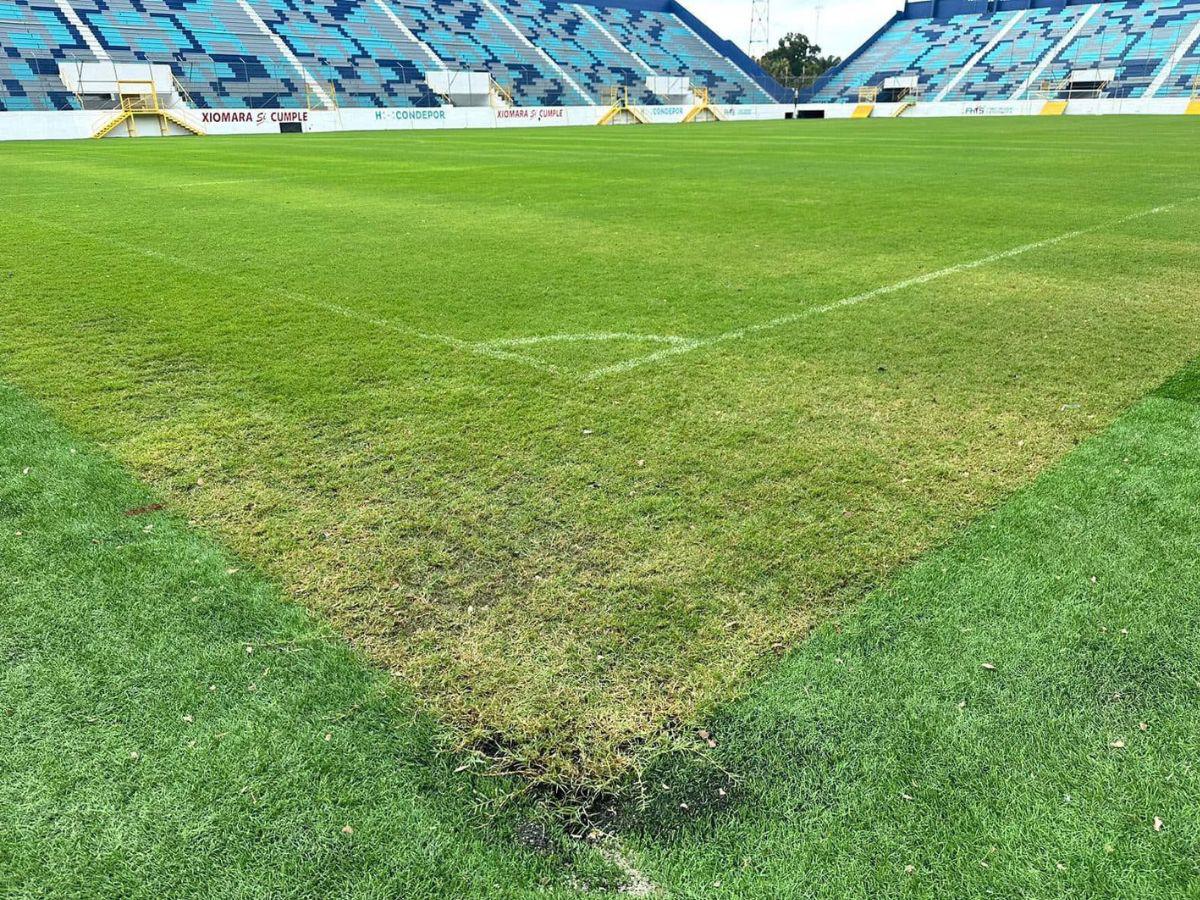 L25 millones pagó Condepor a empresa que no terminó las obras en el Morazán