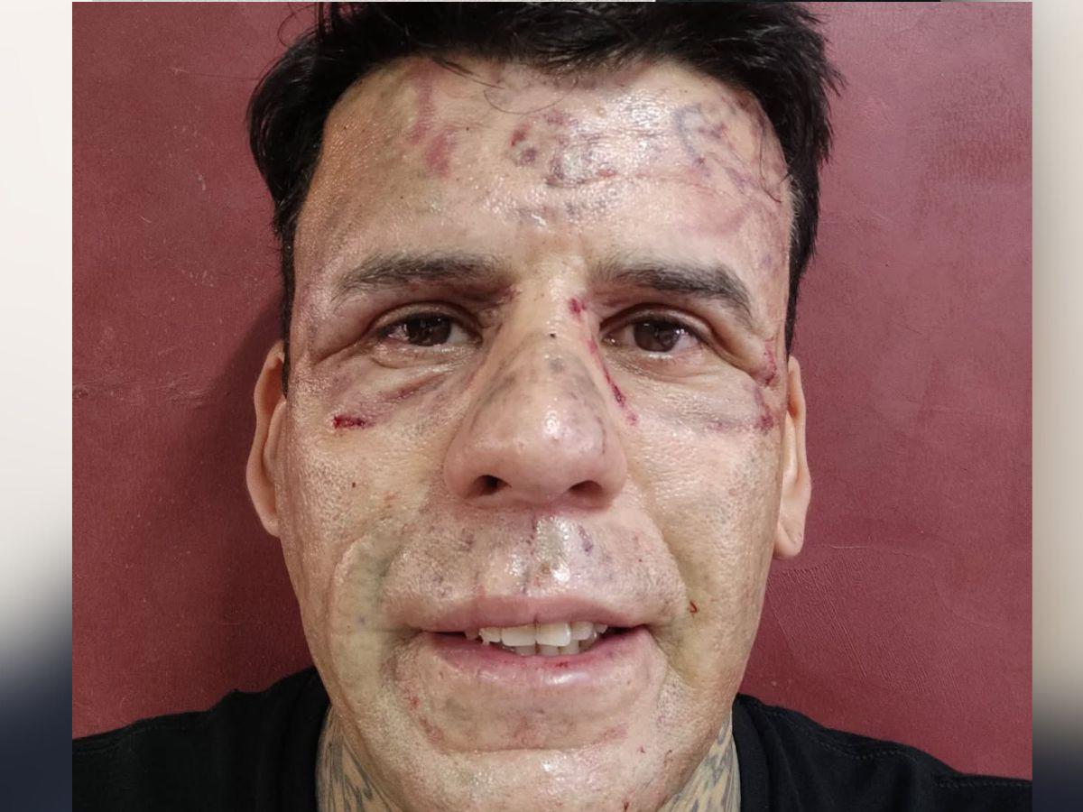 De ser el más tatuado a predicar en las calles: la impactante historia de Alejandro