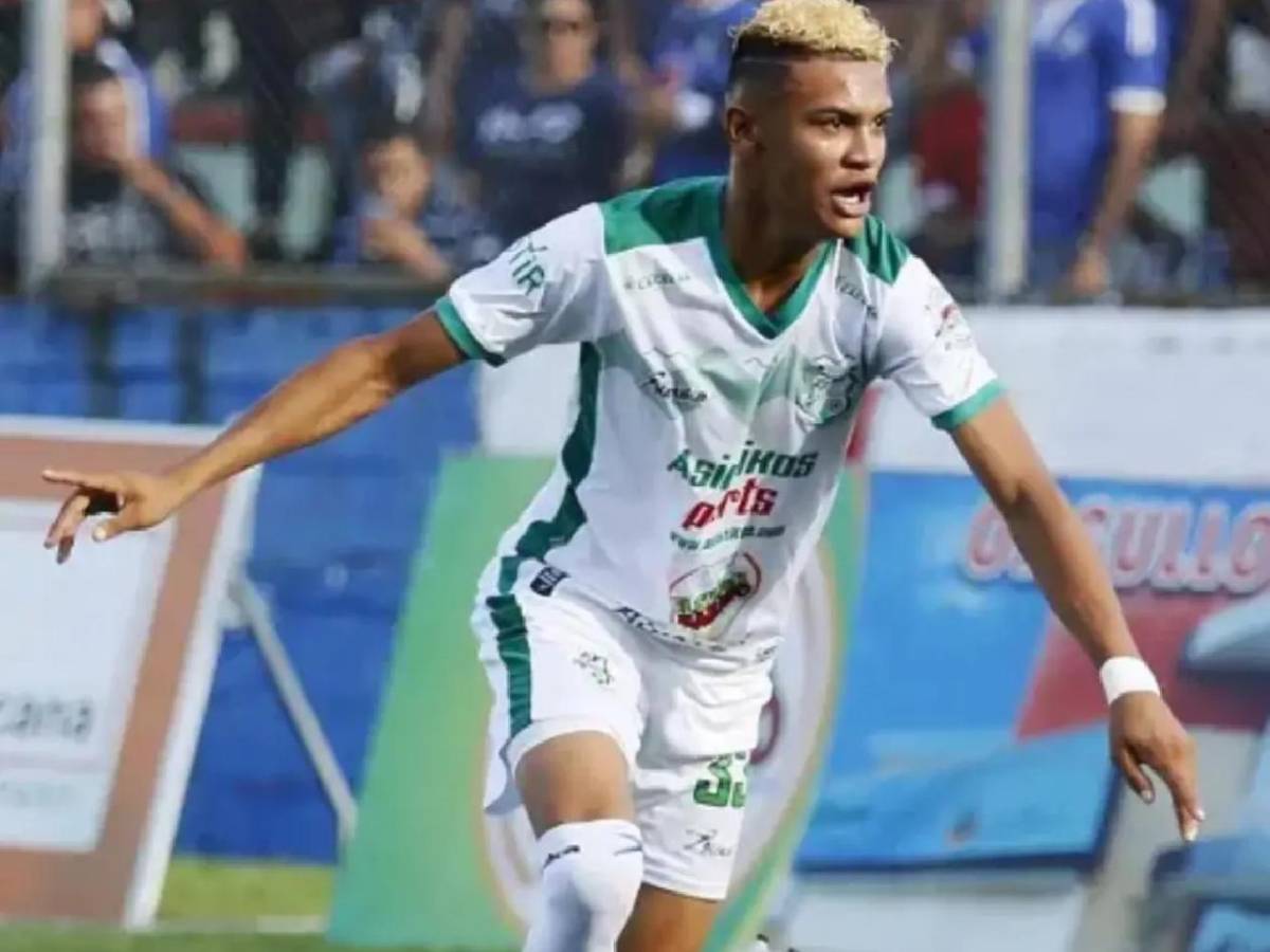 ¡De casi perder el pie a debutar en Champions! La increíble historia de Arriaga