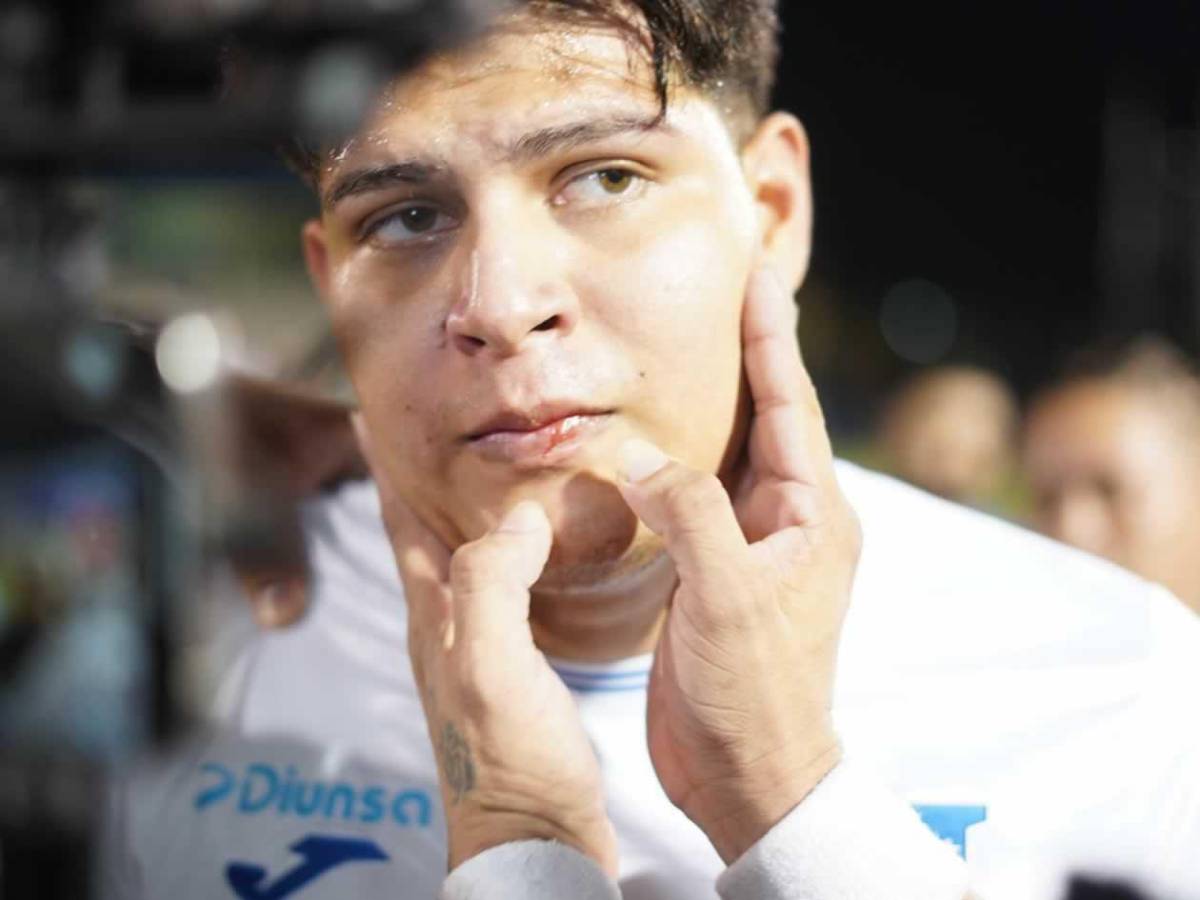 Tiktokers de Honduras con festejo alocado, agresión a Supremo y la bronca en Nicaragua