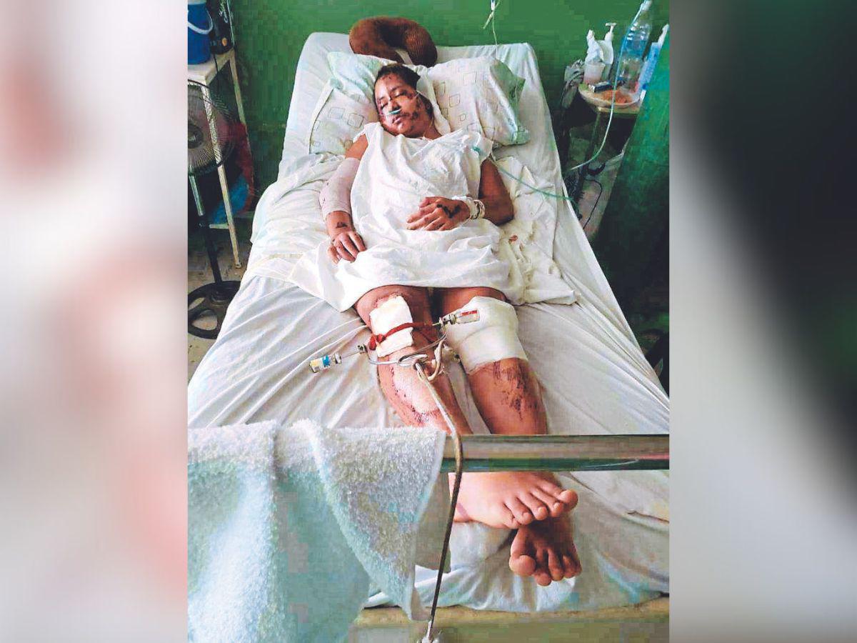 El calvario de Hazel: la sonrisa que no se borró a pesar de la tragedia