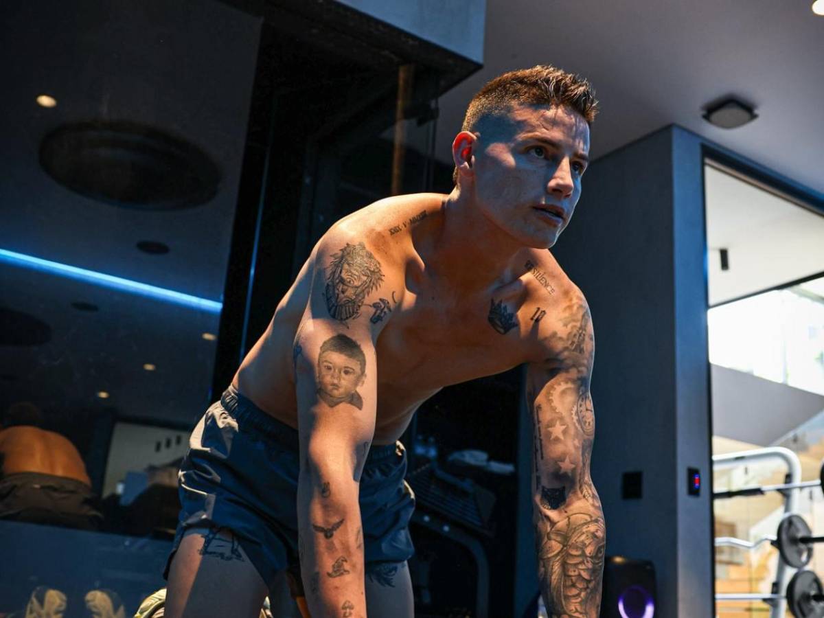 ¿James Rodríguez sufre de rabdomiólisis mortal? Surge noticia sobre el colombiano