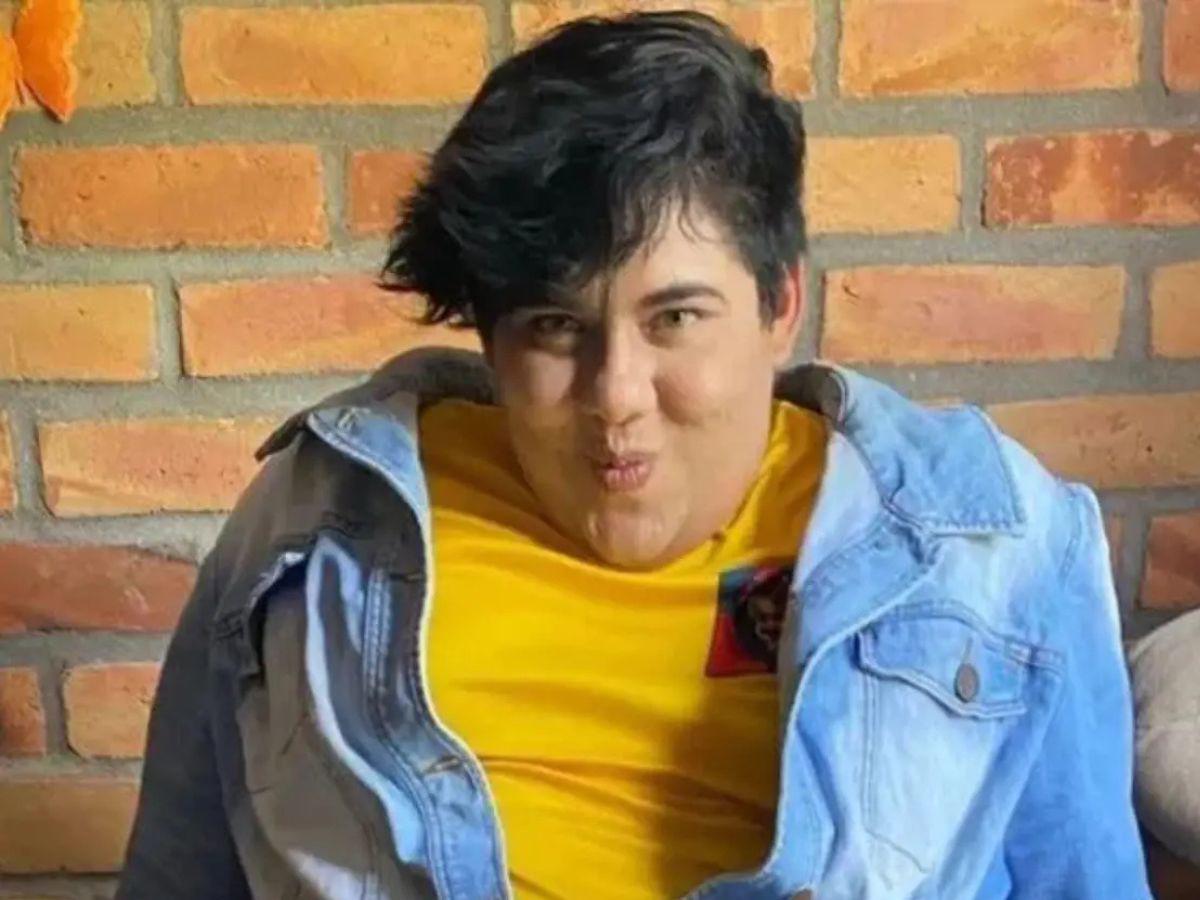 Antonio Sandrez presume sus nuevos labios: “Atáquense y admiren