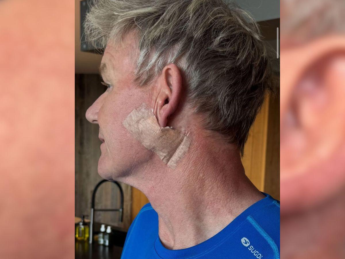 El chef Gordon Ramsay se somete a complicada cirugía tras ser diagnosticado con cáncer