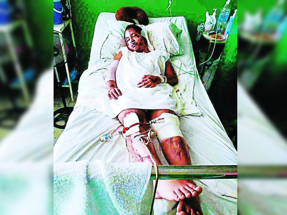 Hazel Michell Cortés necesita dos operaciones