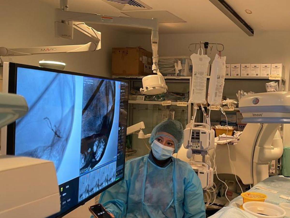 ¿Cómo reconocer a tiempo un derrame cerebral?