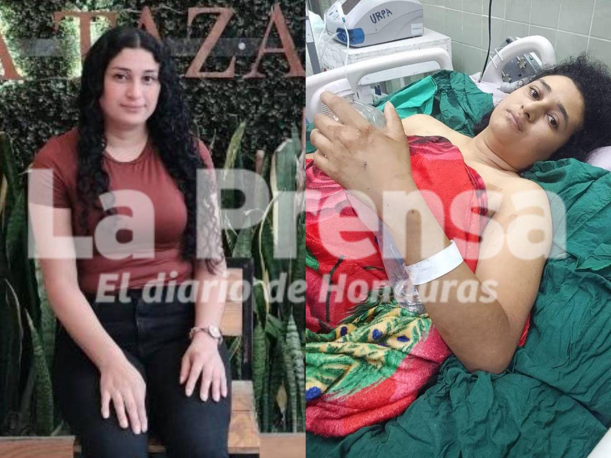 Joven que se cayó de la rueda de Chicago ya fue operada; dueños  de los juegos no le ayudaron