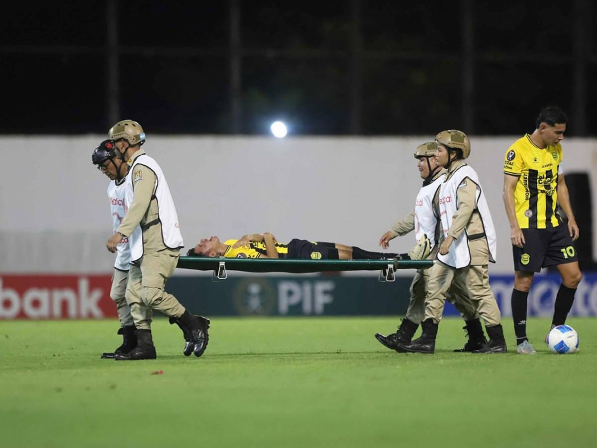La alegría de Real España, grave lesión, jugador caminó descalzoy linda chica enamora