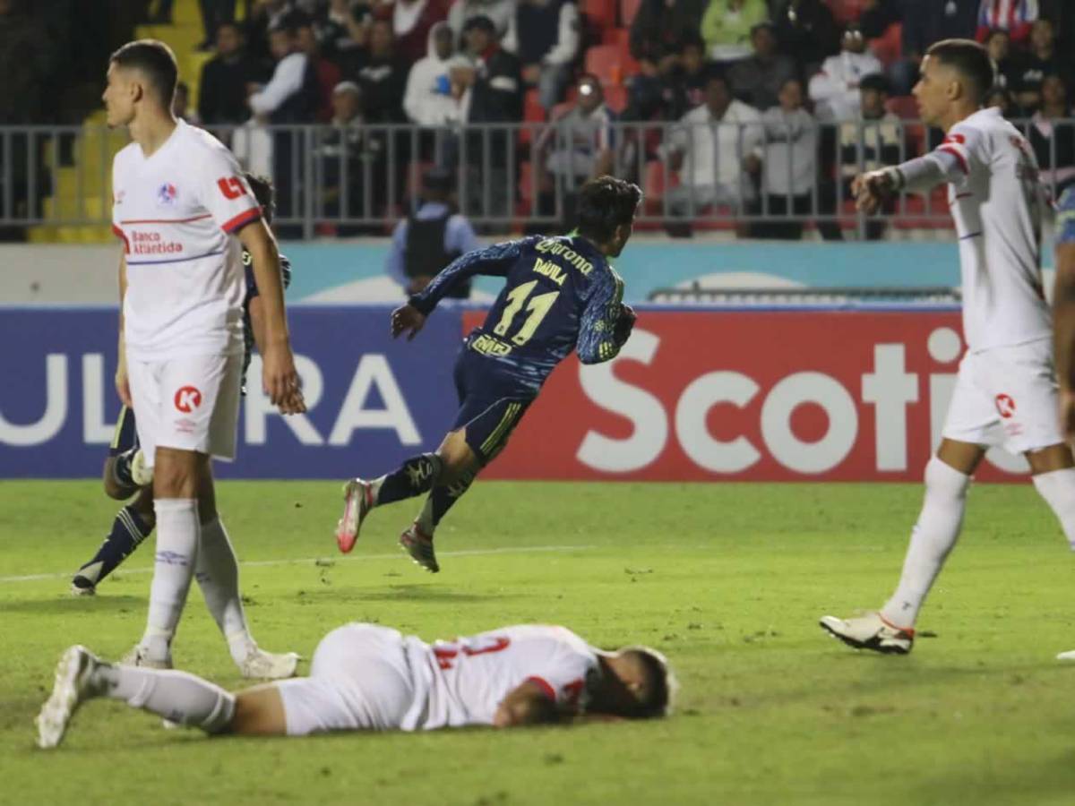 Olimpia se derrumba ante América, dedicatoria de Jorge Álvarez y novia de futbolista