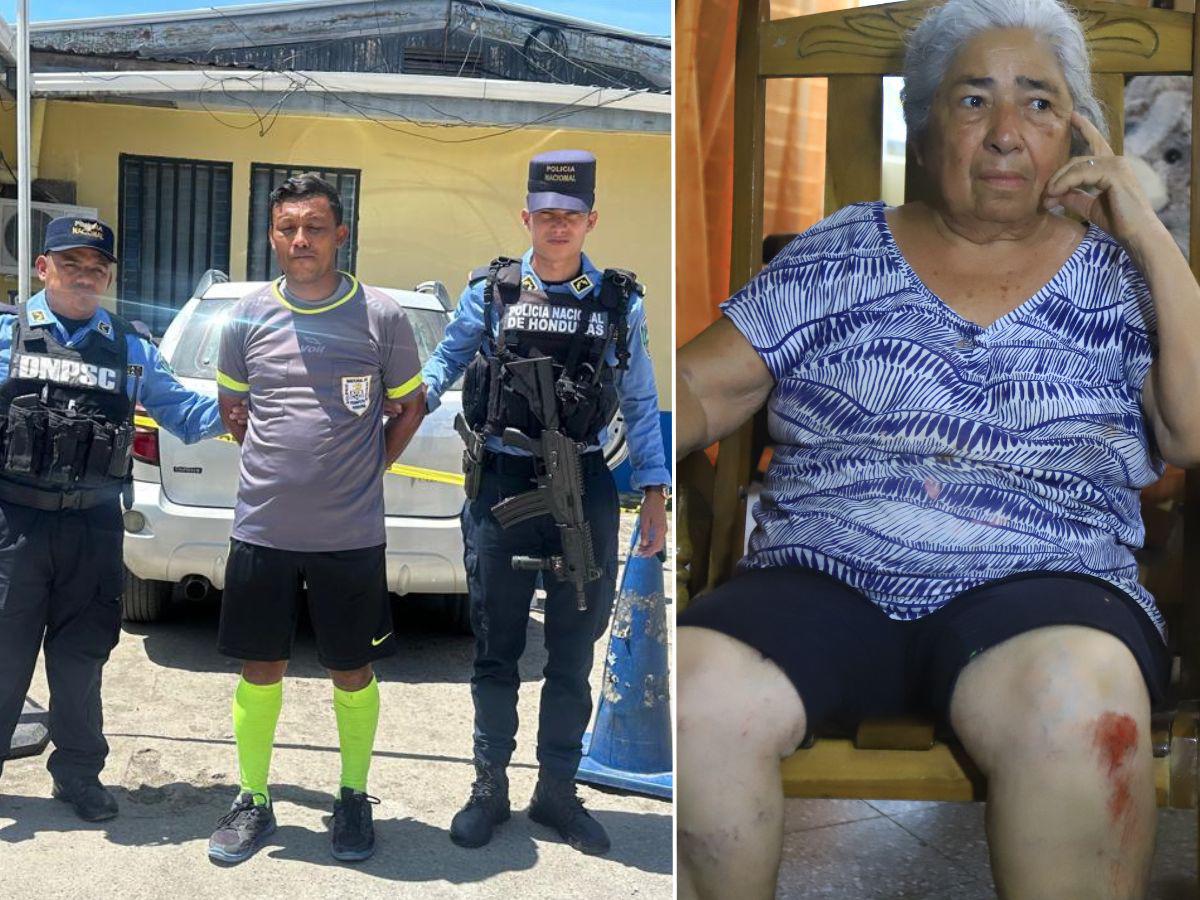 Árbitro intentó matar a anciana al tirarle el carro: Policía