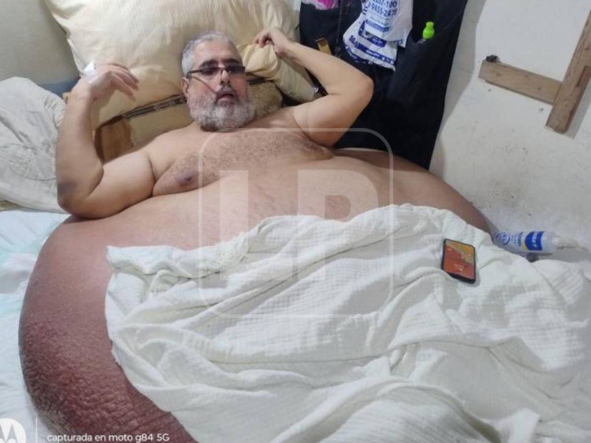 Así alistan hospital para atender de emergencia al hombre más obeso de Honduras