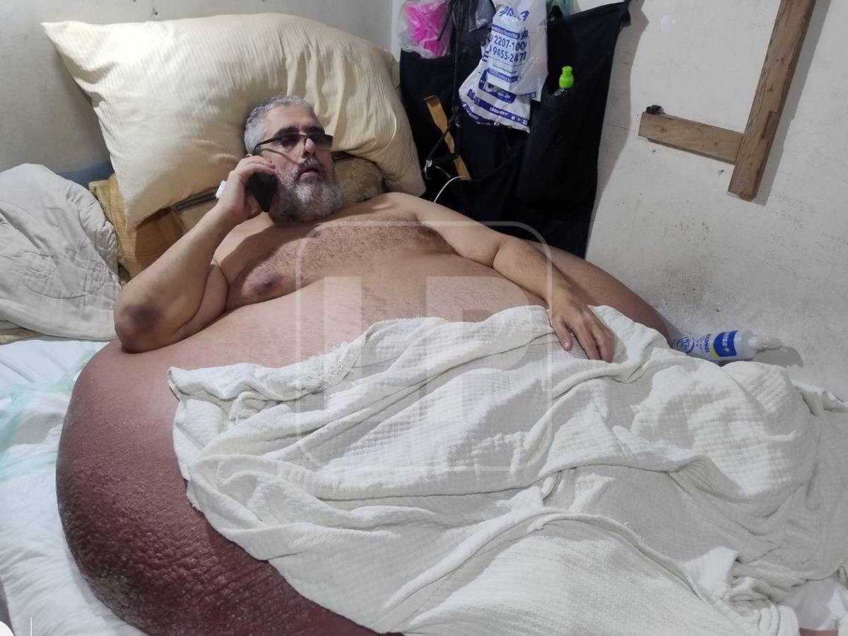 Así alistan hospital para atender de emergencia al hombre más obeso de Honduras