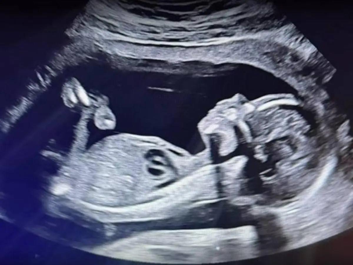 Esto es un milagro de Dios: Jorge Cordero sobre el embarazo de Ana Alvarado