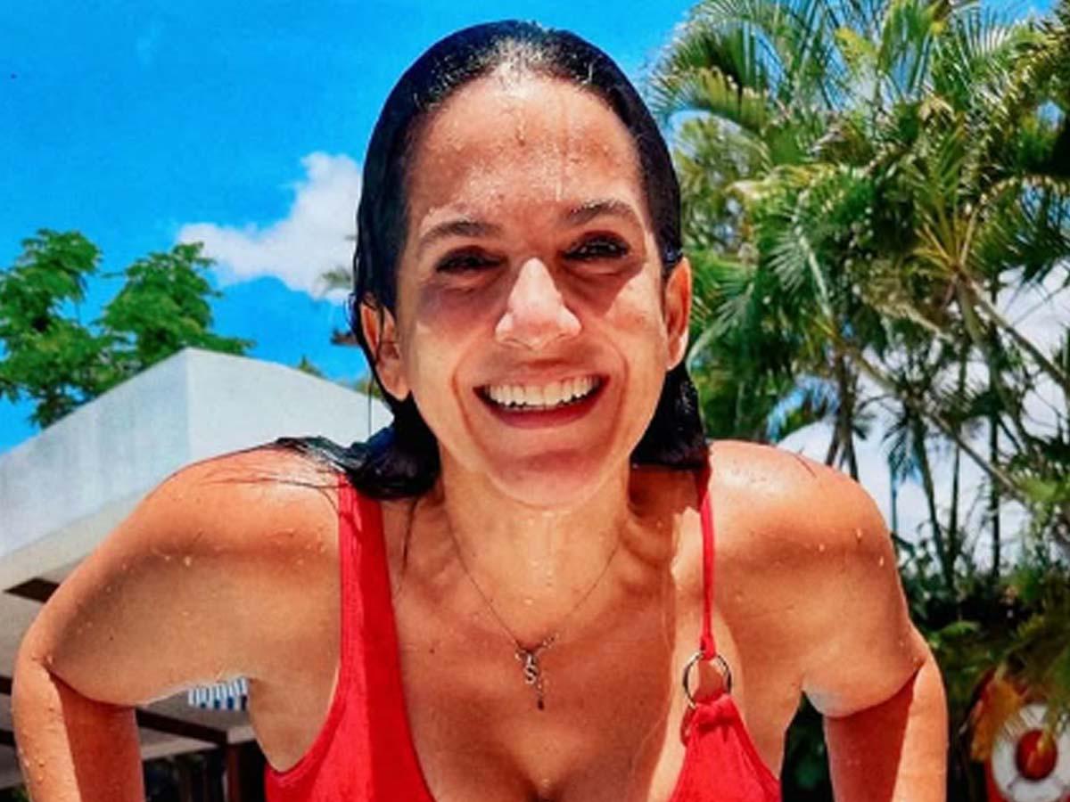 Revelan el tratamiento estético al que se sometió chef Sandra Díaz antes de morir