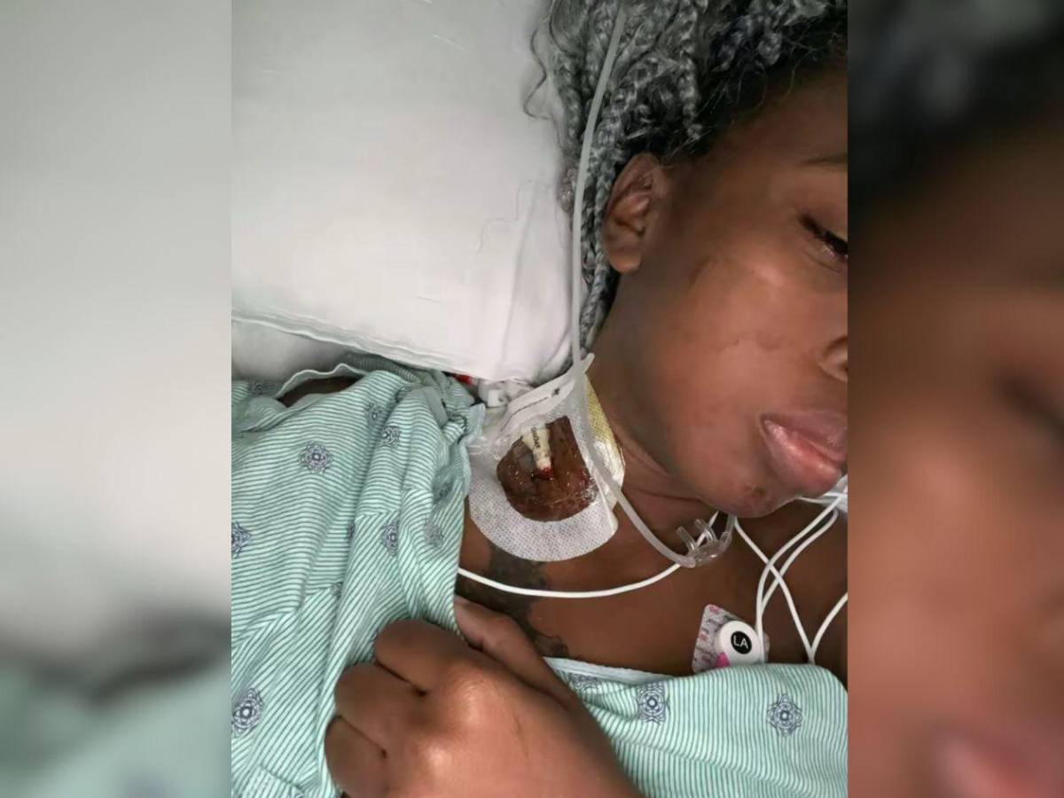 Lidia Arriola es ingresada a UCI para ser operada de emergencia; este es su estado de salud