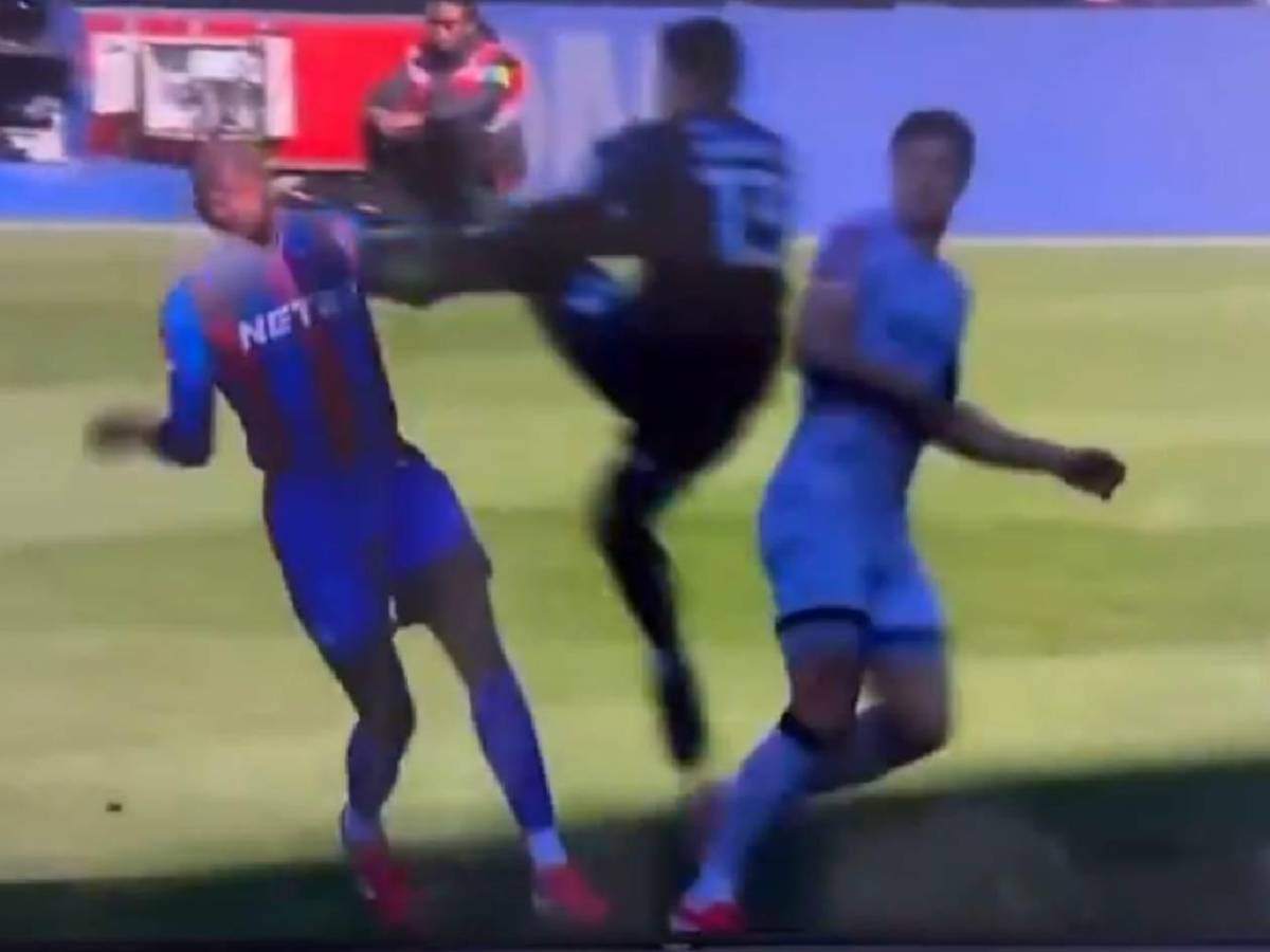 Sufrió una criminal patada en pleno partido y esto informan sobre su estado