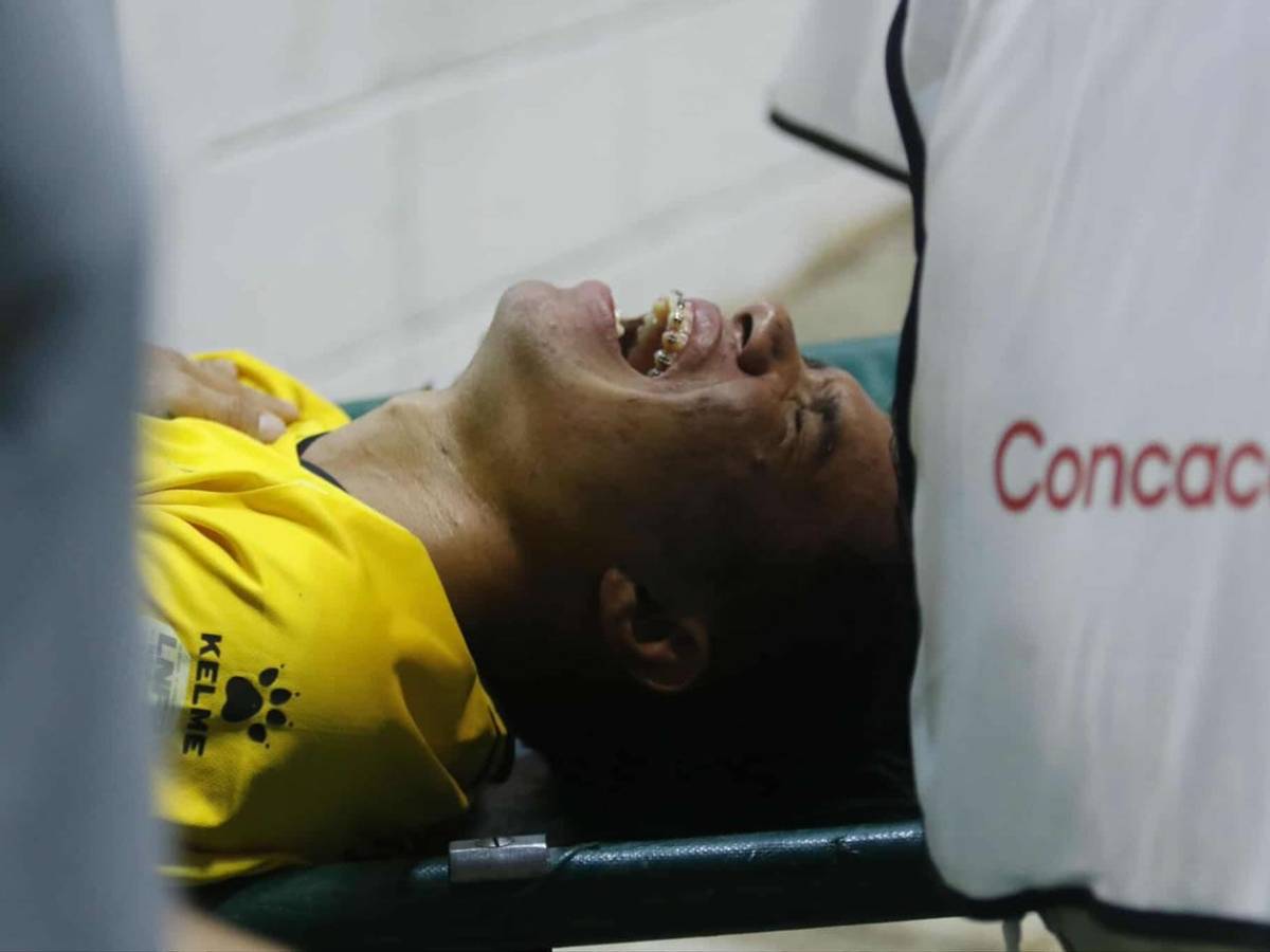 La alegría de Real España, grave lesión, jugador caminó descalzoy linda chica enamora