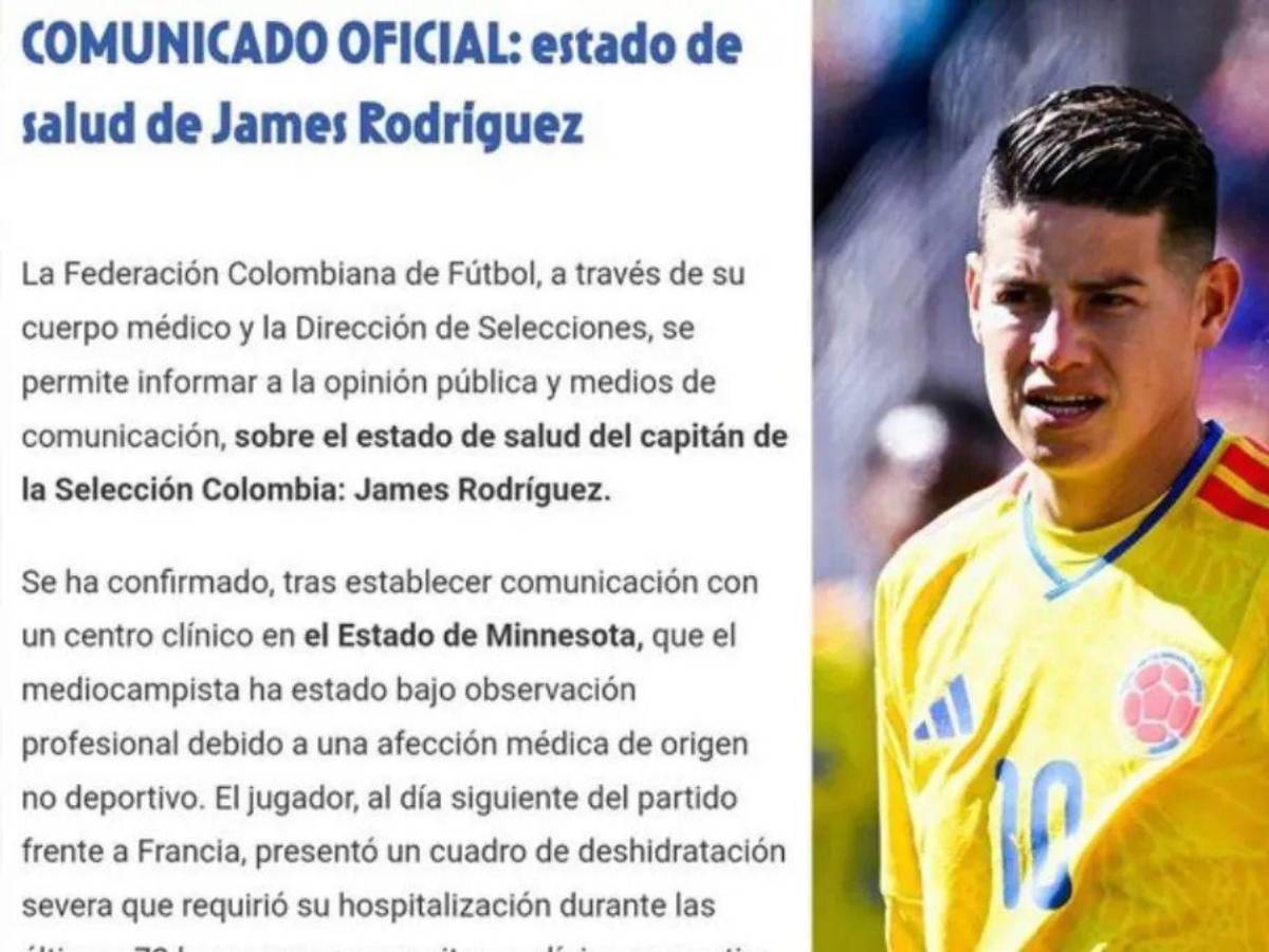 James Rodríguez en alerta: hospitalizado a dos meses del Mundial 2026