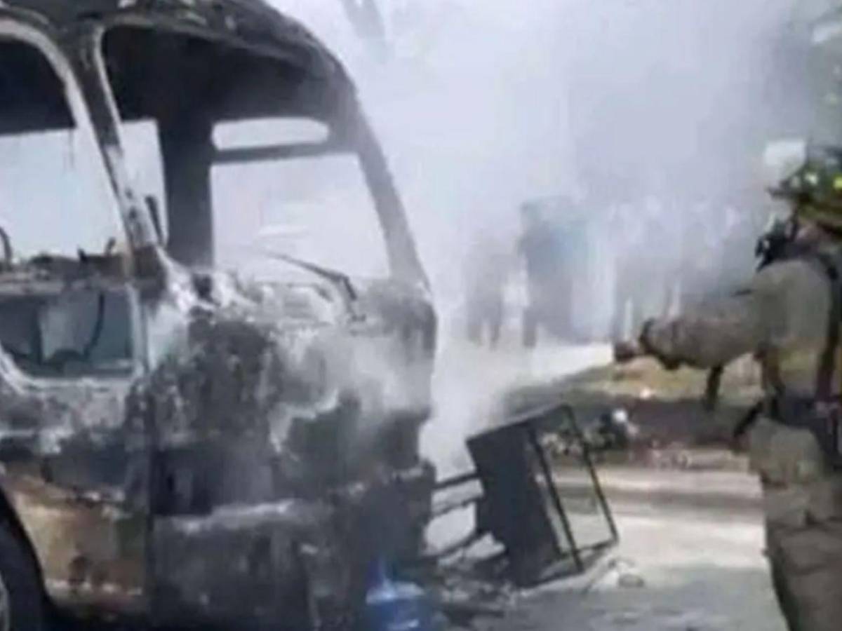 Revelan el estado clínico del hombre que sufrió quemaduras tras accidente en SPS