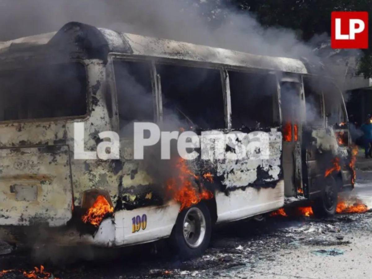 Revelan el estado clínico del hombre que sufrió quemaduras tras accidente en SPS